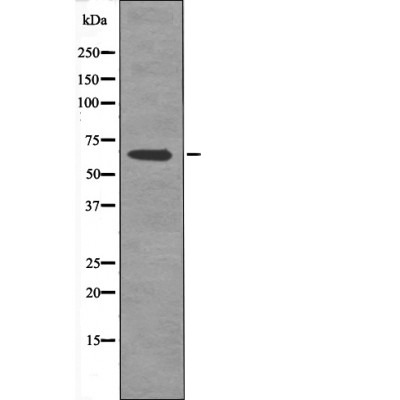 Anti-Phospho-FOXO4 (Thr455) Polyclonal Antibody
