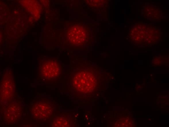 Anti-Phospho-FOXO4 (Ser197) Polyclonal Antibody 2