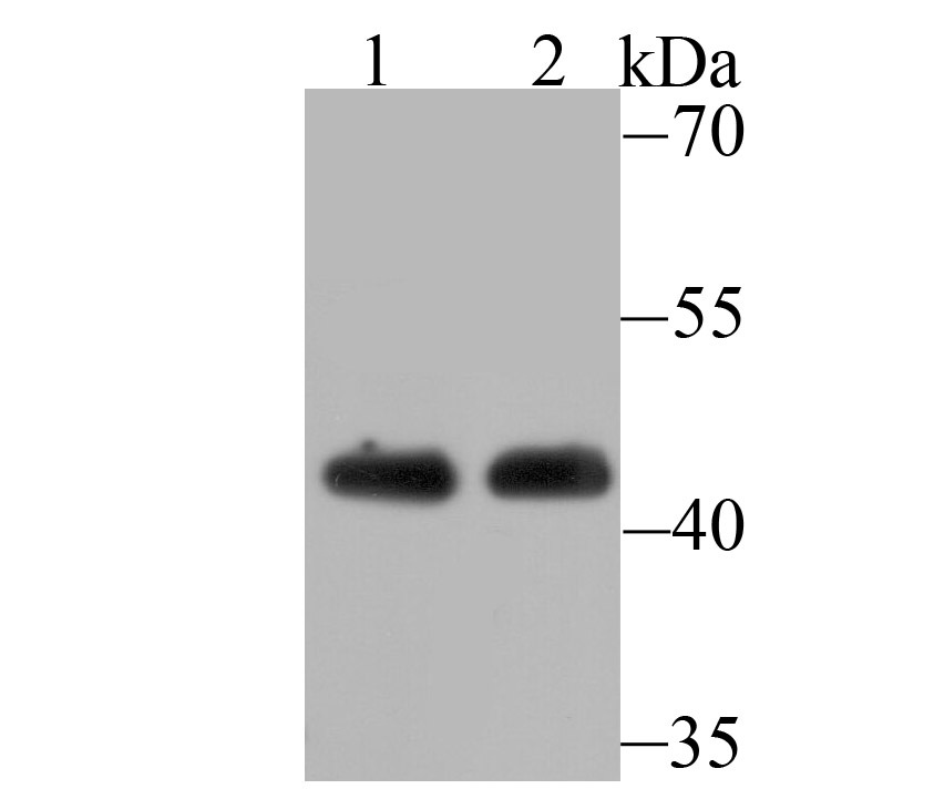 Anti-ACTL6A Antibody (7P351)