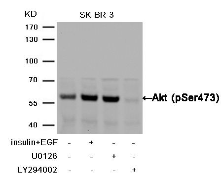 Anti-Phospho-AKT1 (Ser473) Polyclonal Antibody