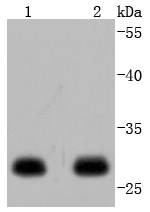 Anti-14-3-3 epsilon Antibody (5E440)