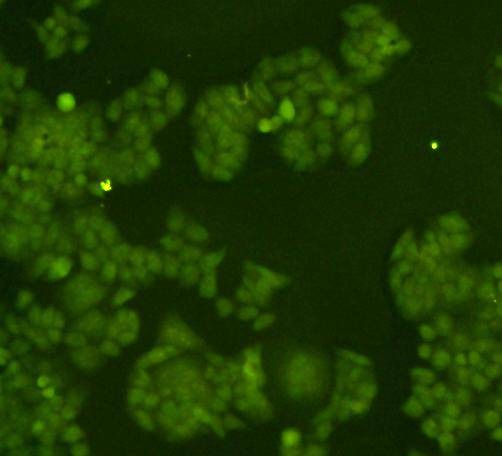 Anti-14-3-3 beta/alpha Antibody (7Q362)