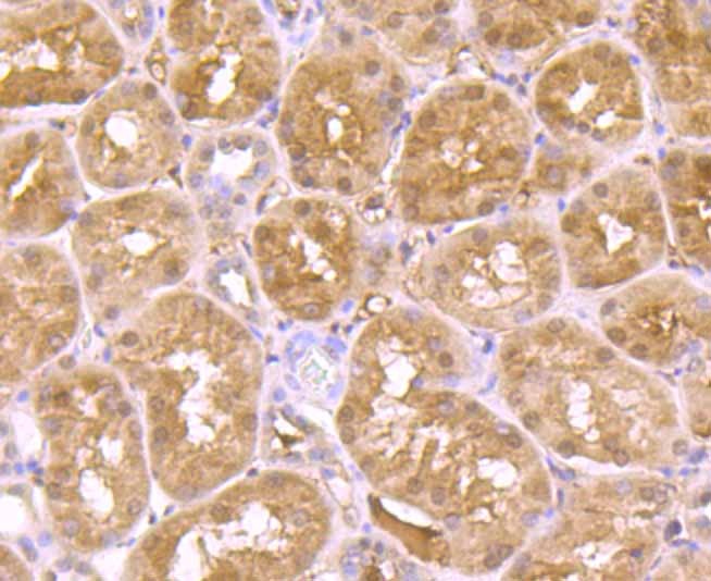 Anti-ADAR Antibody (6K725)