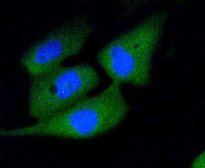 Anti-Caspase-3 Antibody (6C392)