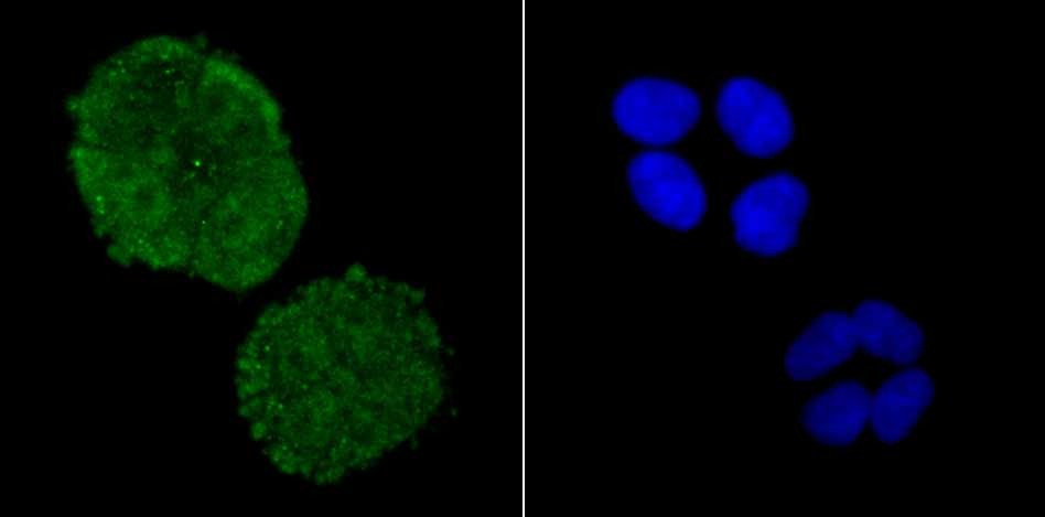 Anti-ADAR Antibody (6K725)