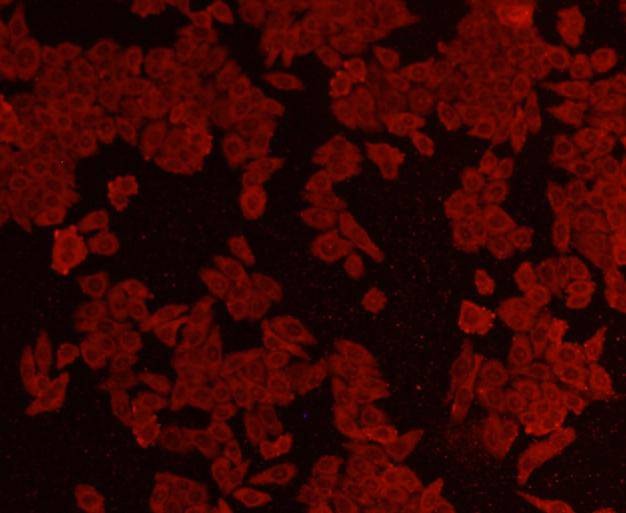 Anti-AKT1 Antibody (7N506)