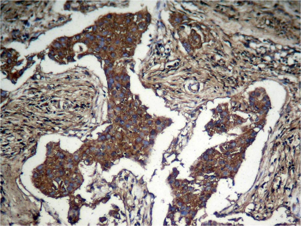 Anti-Phospho-AKT1 (Ser473) Polyclonal Antibody