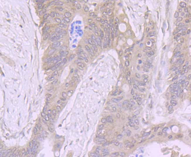 Anti-ADAR Antibody (6K725)