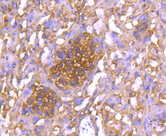Anti-14-3-3 epsilon Antibody (5E440)