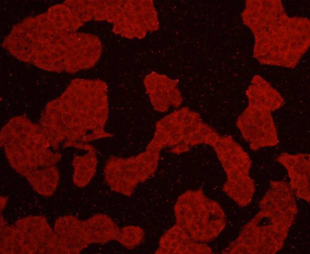 Anti-AKT1 Antibody (7N506)