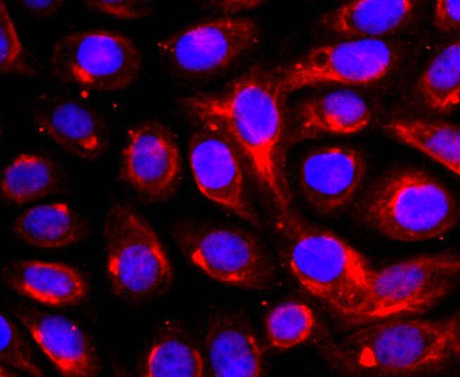 Anti-ADAM17 Antibody (6O847)