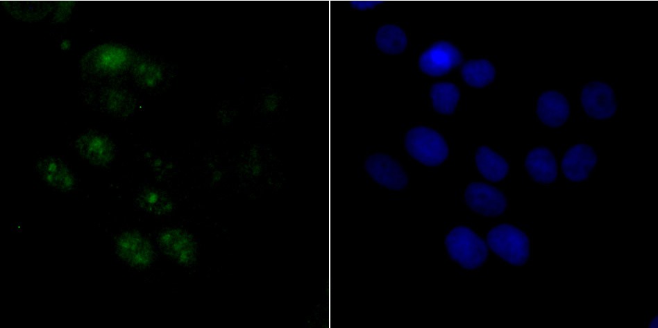 Anti-ACTL6A Antibody (7P351)