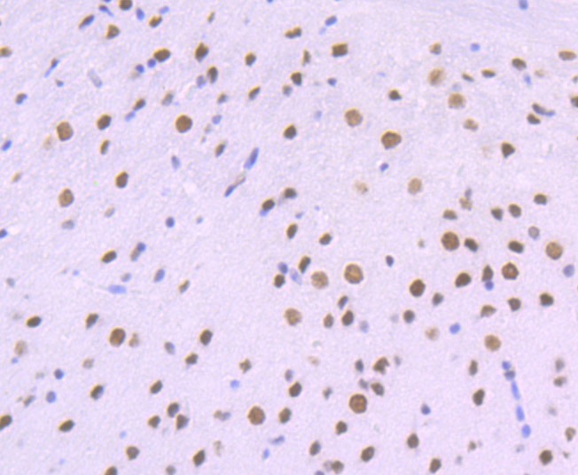 Anti-ACTL6A Antibody (7P351)