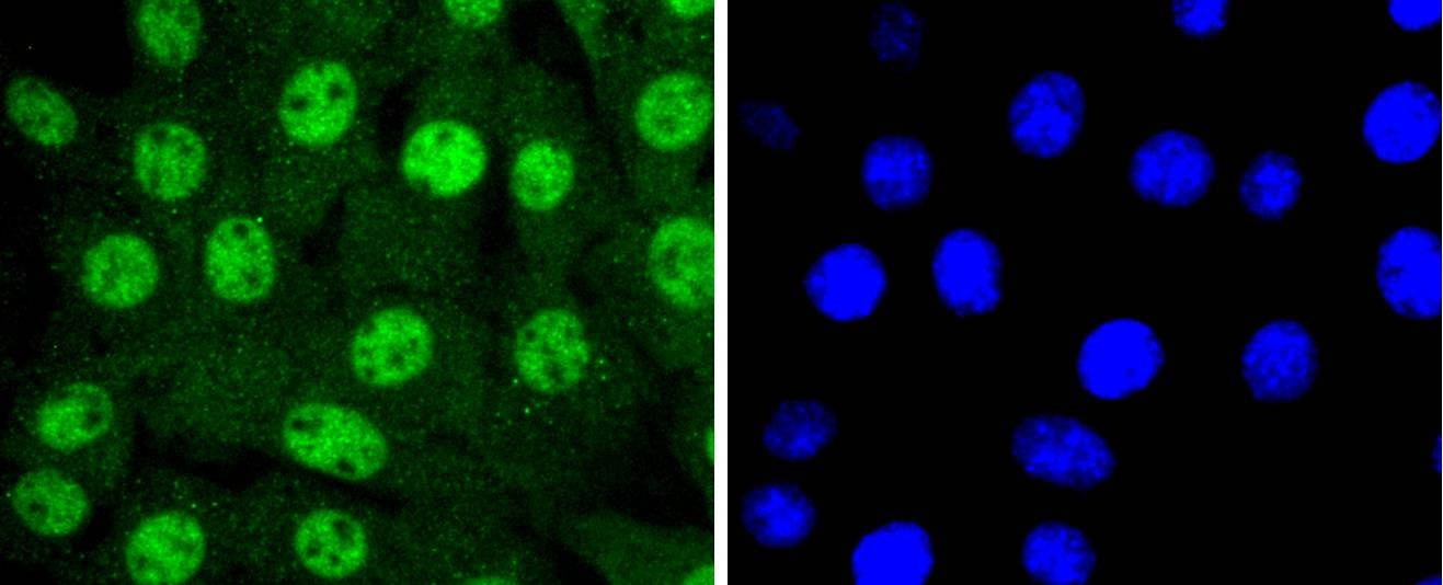 Anti-14-3-3 epsilon Antibody (5E440)