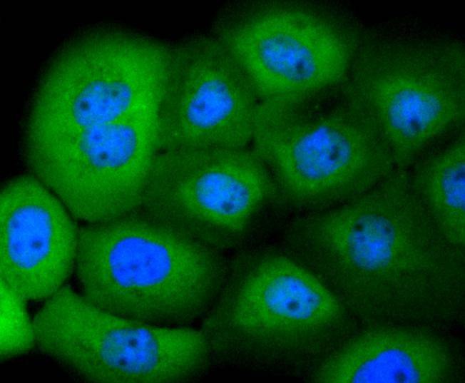Anti-14-3-3 beta/alpha Antibody (6Z701)