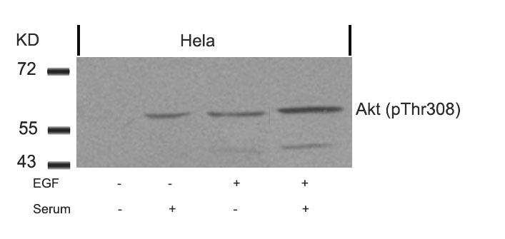 Anti-Phospho-AKT1 (Thr308) Polyclonal Antibody