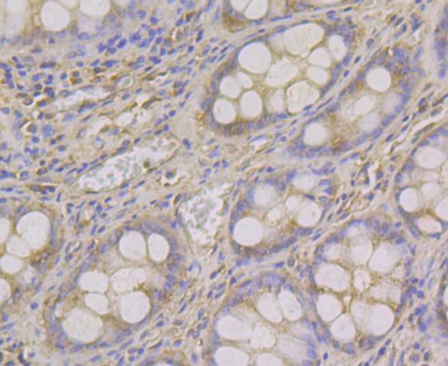 Anti-ADAMTS13 Antibody (1C436)