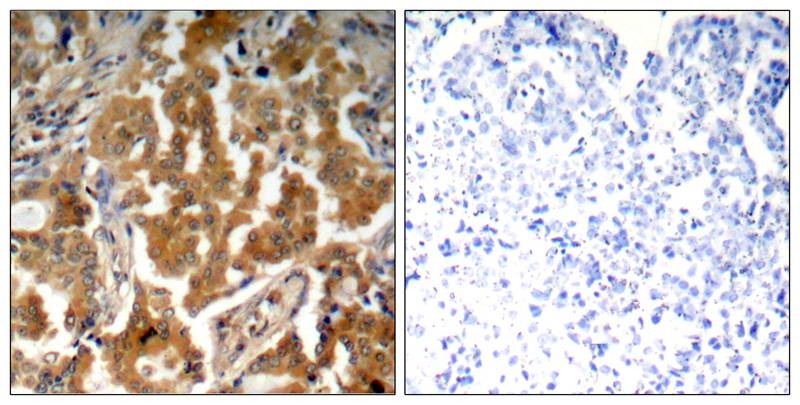 Anti-Phospho-ADD1 (Ser726) Polyclonal Antibody