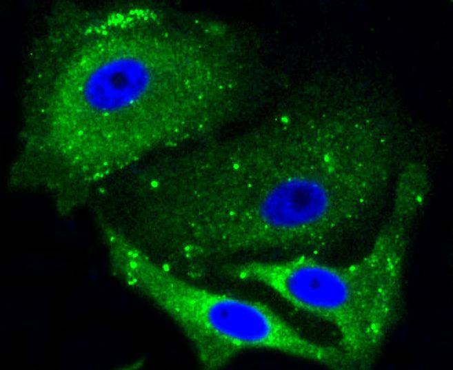 Anti-ALAS1 Antibody (7J767)