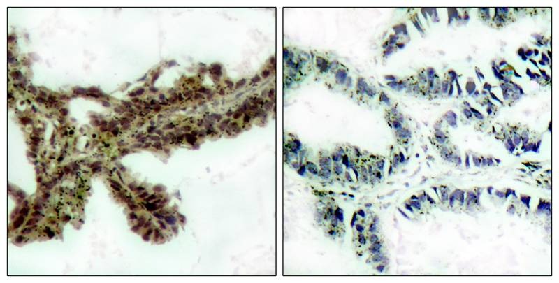 Anti-Phospho-AKT1 (Thr308) Polyclonal Antibody