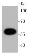 Anti-AKT1 Antibody (2R814)