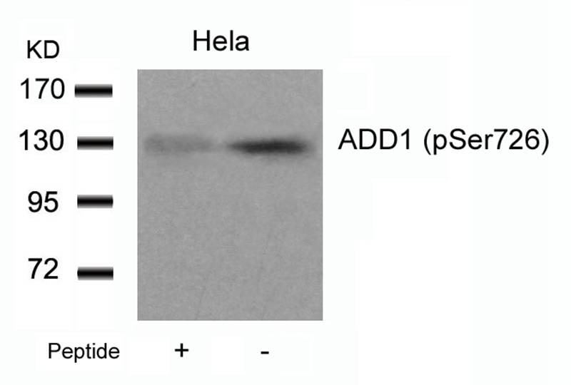 Anti-Phospho-ADD1 (Ser726) Polyclonal Antibody