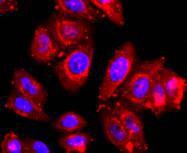 Anti-ADAM17 Antibody (6O847)