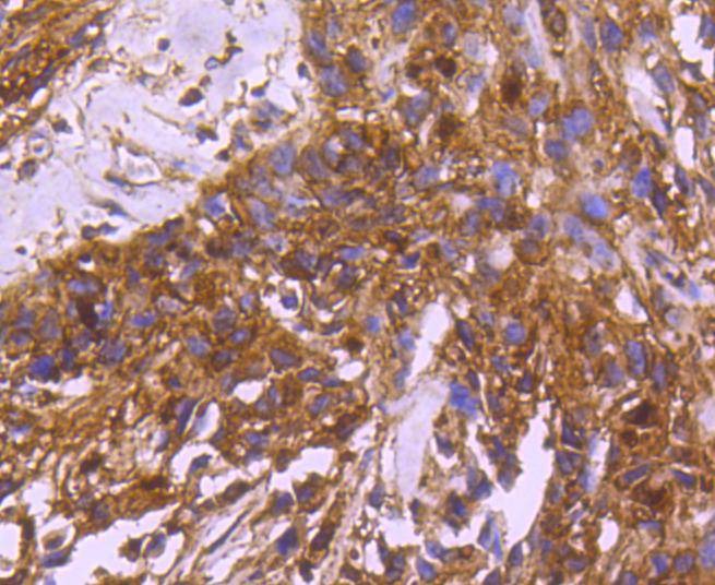 Anti-14-3-3 beta/alpha Antibody (6Z701)