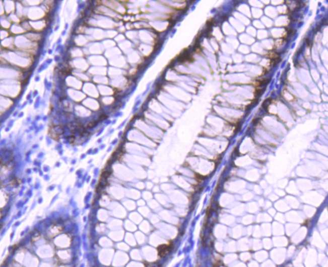 Anti-AGR2 Antibody (7E227)