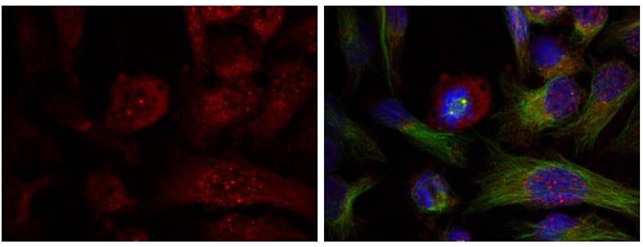 Anti-Phospho-AKT1 (Thr308) Polyclonal Antibody