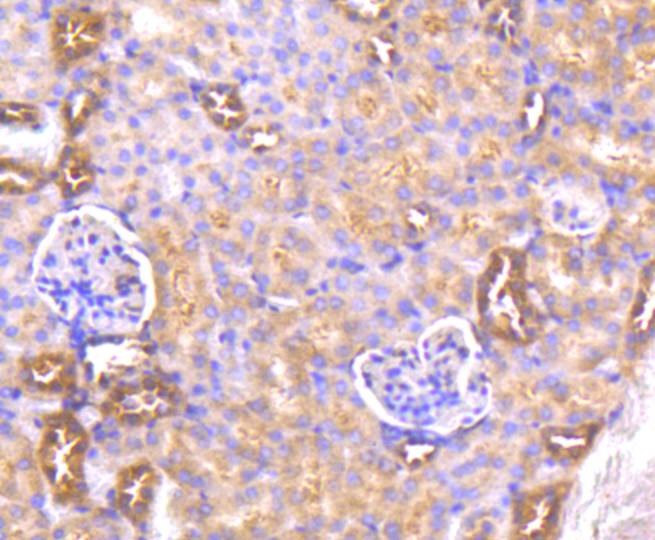 Anti-AKT1 Antibody (2R814)