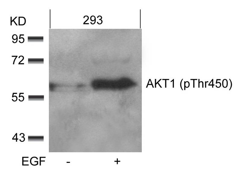 Anti-Phospho-AKT1 (Thr450) Polyclonal Antibody