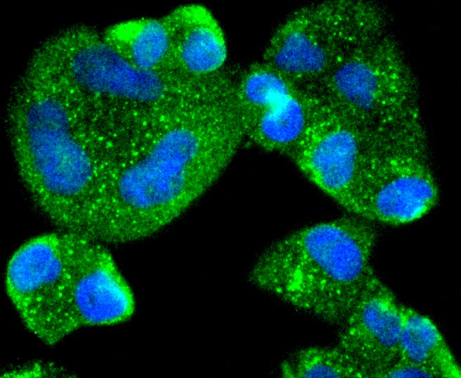 Anti-AGR2 Antibody (7E227)