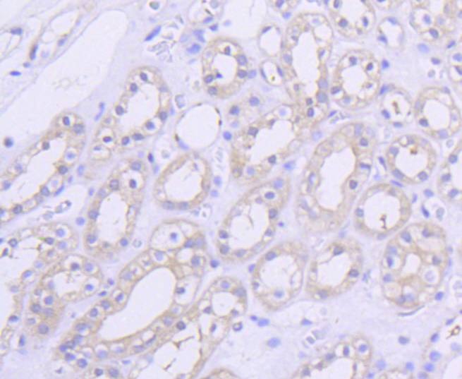 Anti-AKT1 Antibody (2R814)