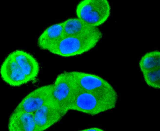 Anti-14-3-3 beta/alpha Antibody (6Z701)