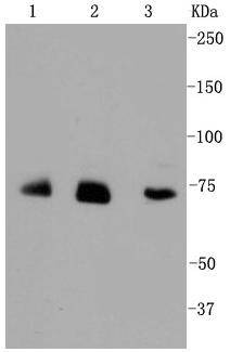 Anti-ALAS1 Antibody (7J767)