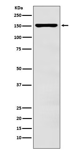 Anti-ADAR Antibody (6K725)