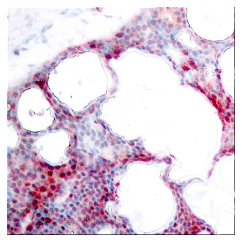 Anti-Phospho-ATF2 (Ser62 or 44) Polyclonal Antibody