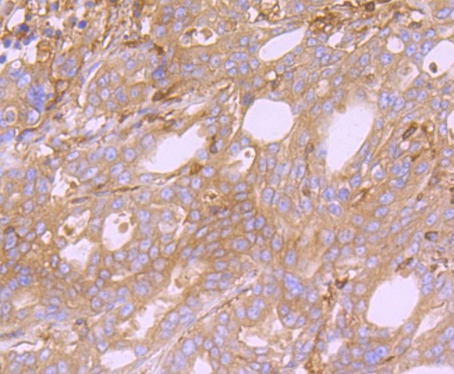 Anti-Arp3/ACTR3 Antibody (1Q436)