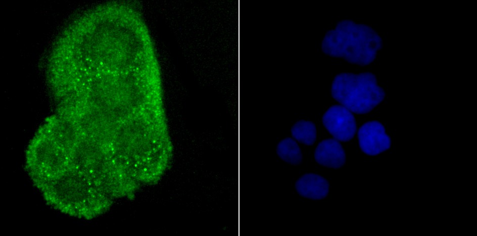 Anti-CRYAB Antibody (6W222)