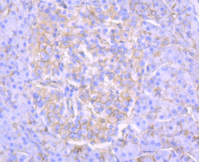 Anti-SPTAN1 Antibody (8O990)