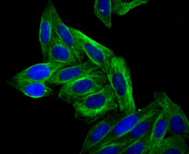 Anti-Arp3/ACTR3 Antibody (1Q436)