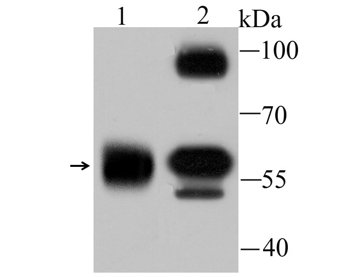 Anti-alpha Internexin Antibody (3U304)