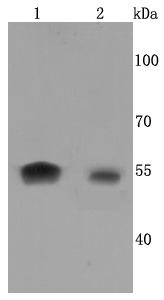 Anti-Aromatase/CYP19A1 Antibody (3T740)