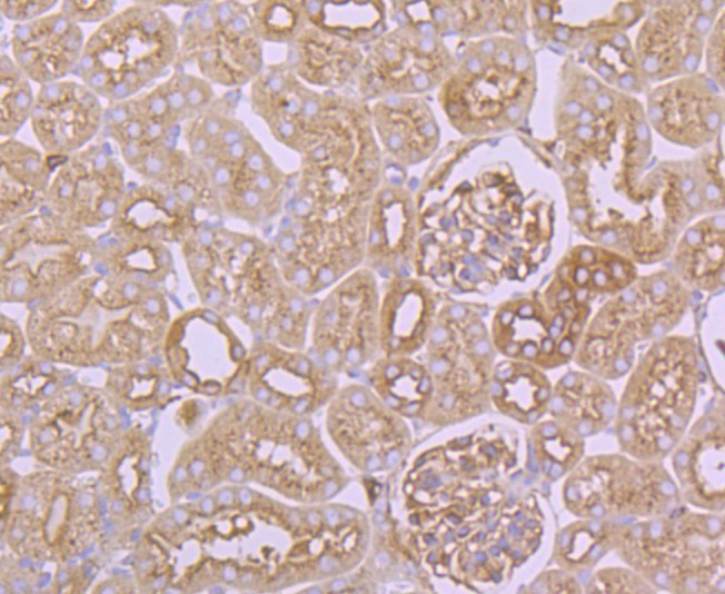 Anti-Arp3/ACTR3 Antibody (1Q436)