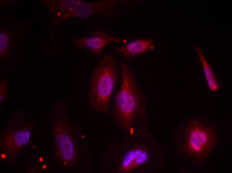 Anti-Phospho-ATF2 (Thr69 or 51) Polyclonal Antibody