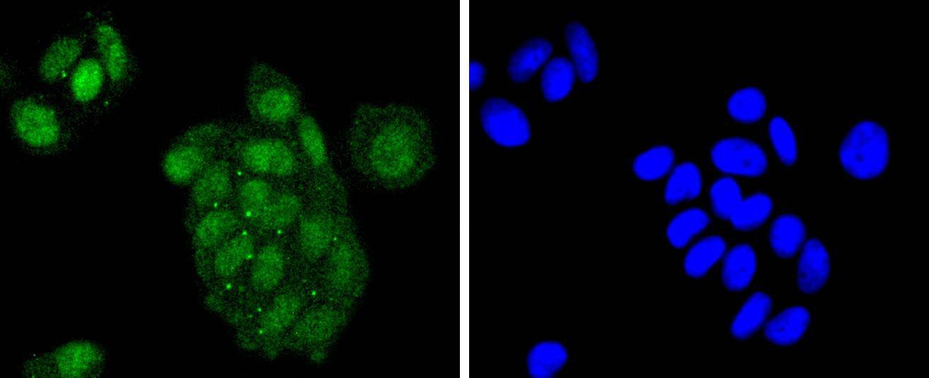 Anti-ATF2 Antibody (4L818)