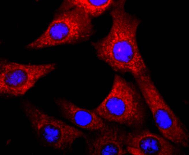 Anti-AHR Antibody (8Z303)