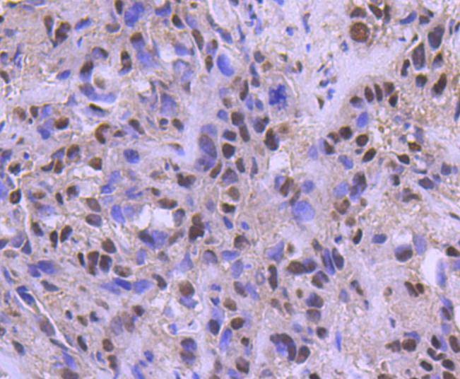 Anti-ATF2 Antibody (4L818)