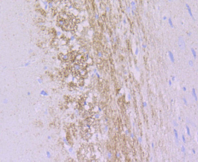 Anti-alpha Internexin Antibody (3U304)